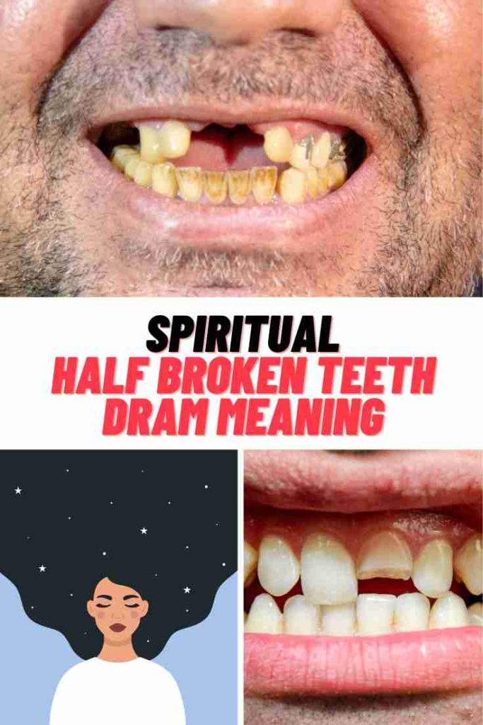 Half Broken Teeth Dream Meaning